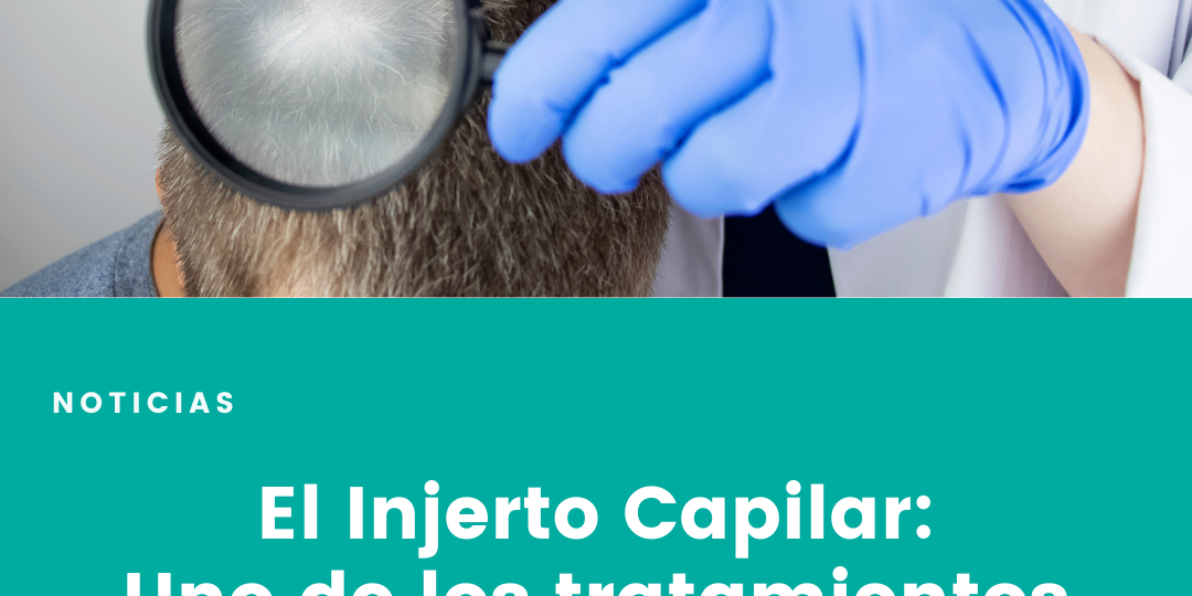 cailar